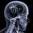 littlebrain